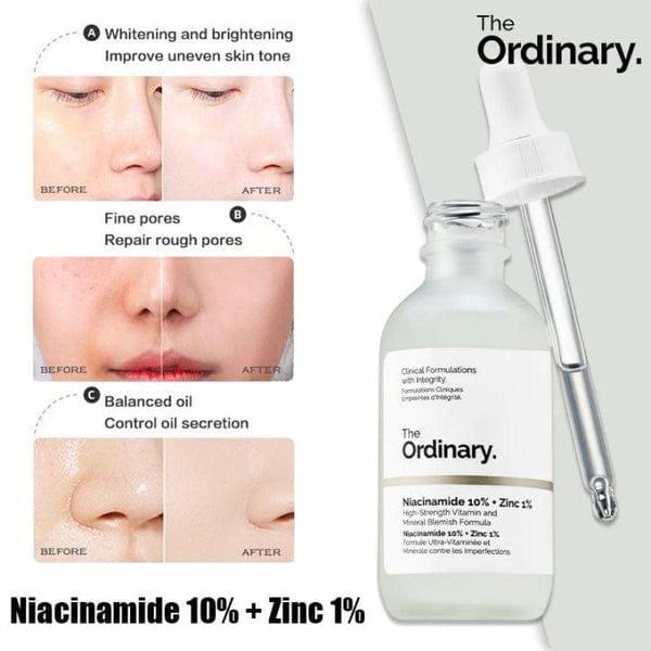 The Ordinary Niacinamide 10% + Zinc 1% Face Serum – Brightening, Oil Control & Pore Minimizing Serum