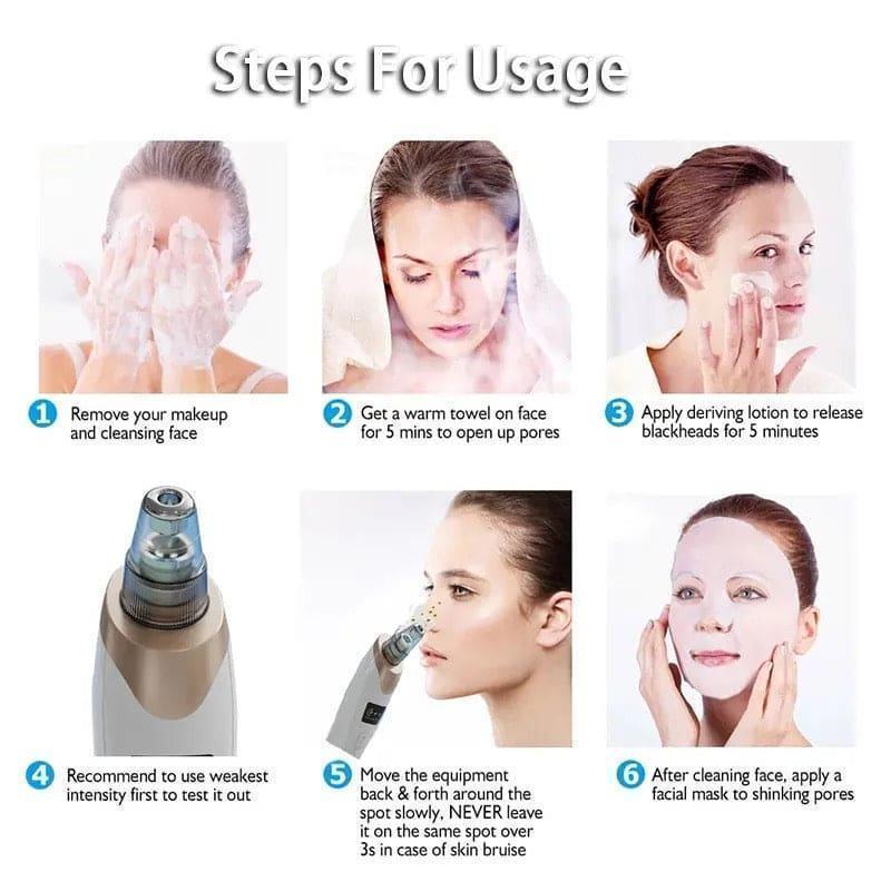 5-in-1 Electric Blackhead Remover Vacuum – Deep Pore Cleanser with 5 Replaceable Suction Heads for Blackheads, Whiteheads & Facial Skin Care