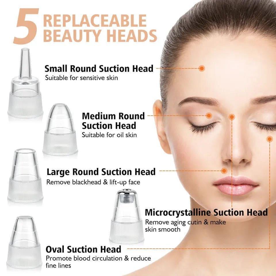 5-in-1 Electric Blackhead Remover Vacuum – Deep Pore Cleanser with 5 Replaceable Suction Heads for Blackheads, Whiteheads & Facial Skin Care