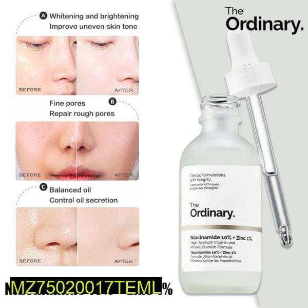The Ordinary Niacinamide 10% + Zinc 1% Face Serum – Brightening, Oil Control & Pore Minimizing Serum